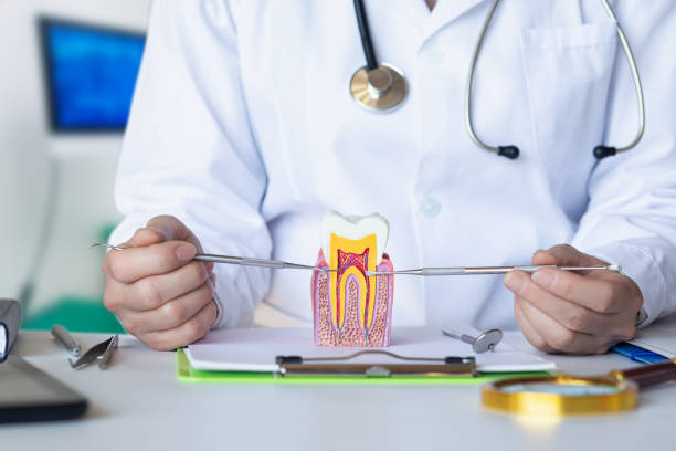 Best Knocked-Out Tooth (Avulsed Tooth) Treatment in Carrollton, TX